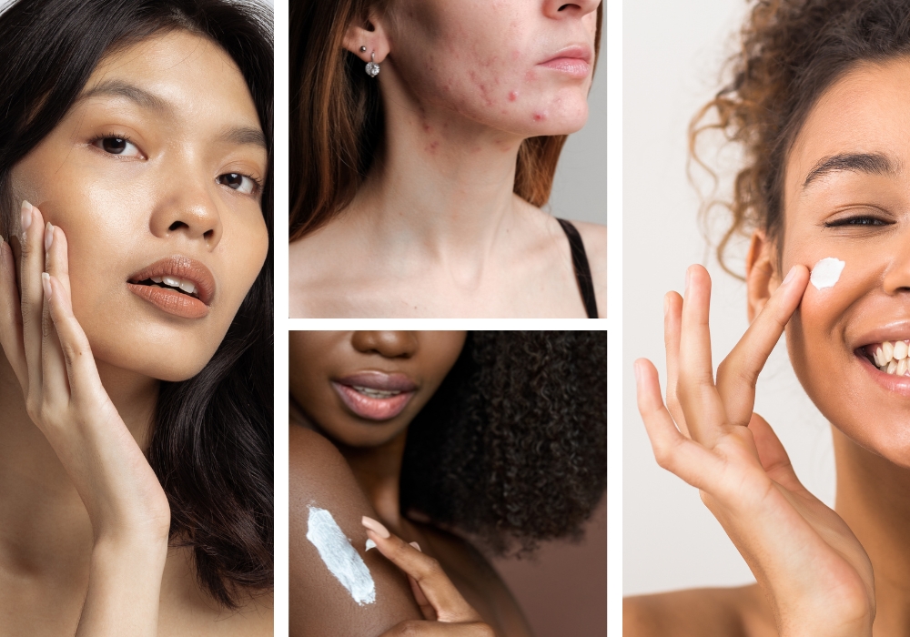ceramides skincare