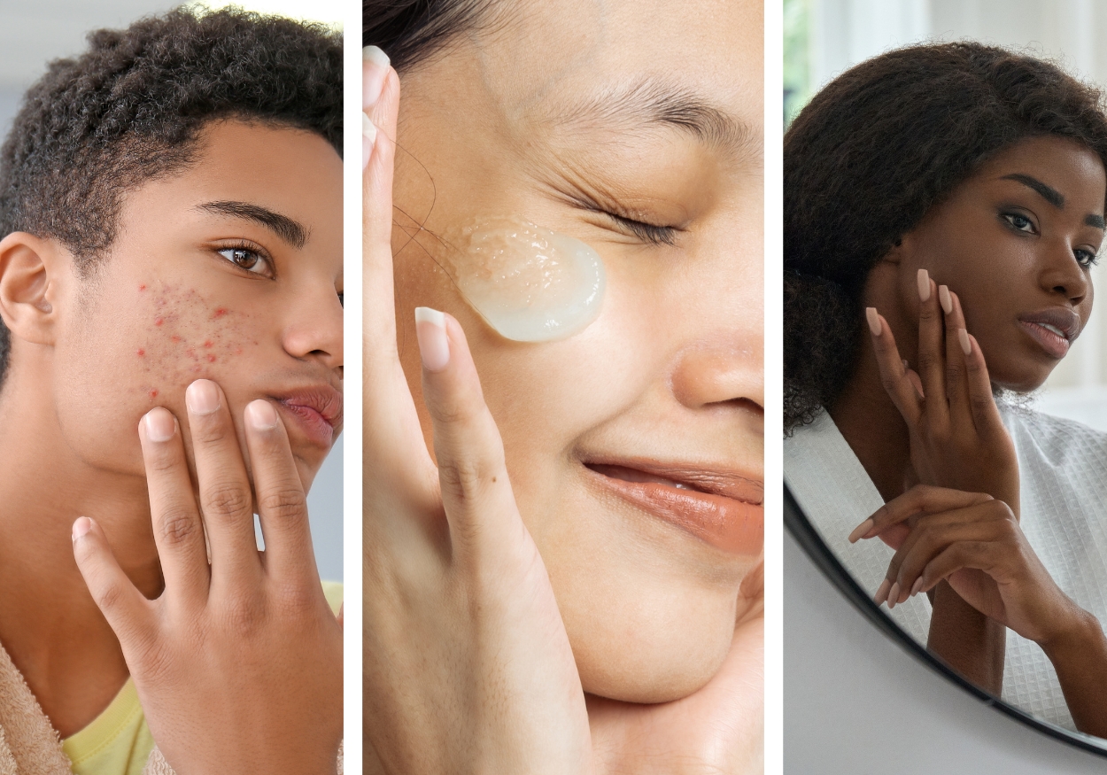 skin barrier