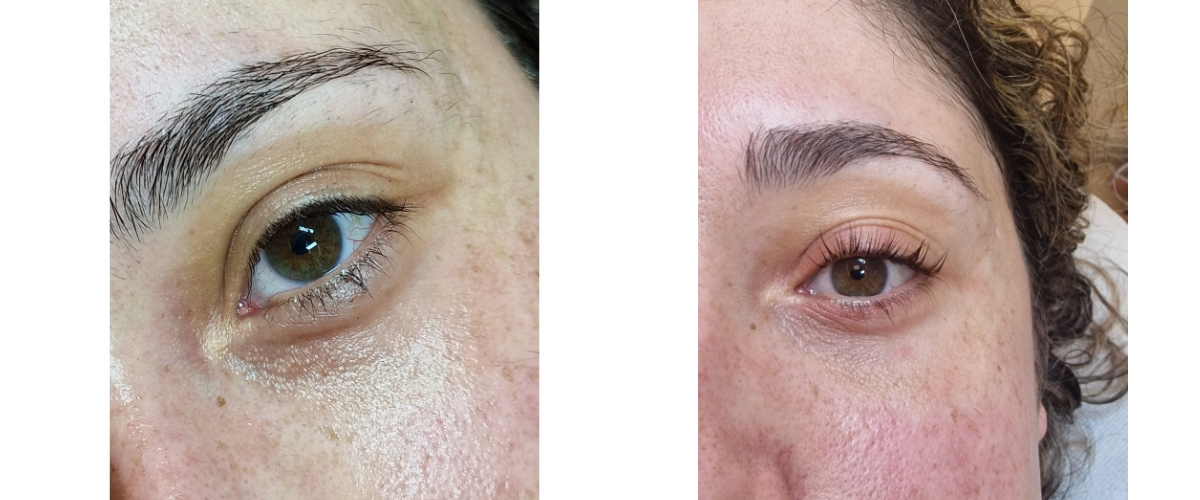 lash lift